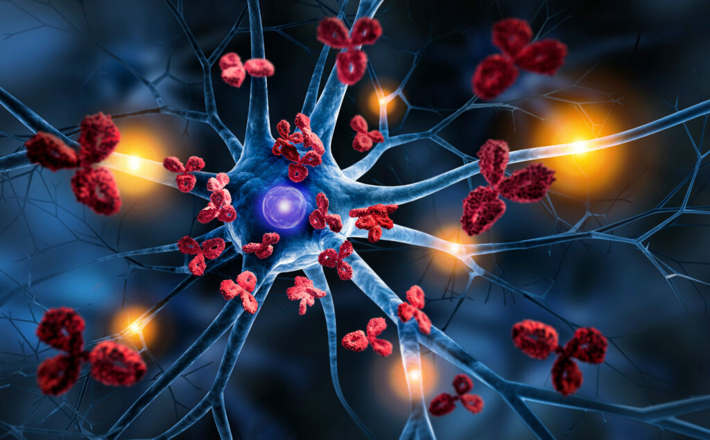 nerve cells with antibodies autoimmune