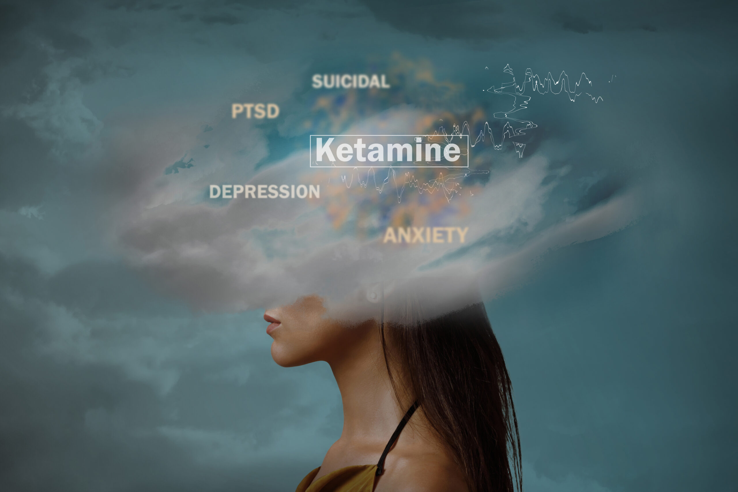 ketamine-treatment-maxwell-clinic-nashville